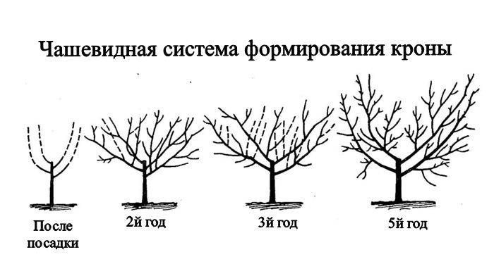 Чашевидная крона черешни.jpg